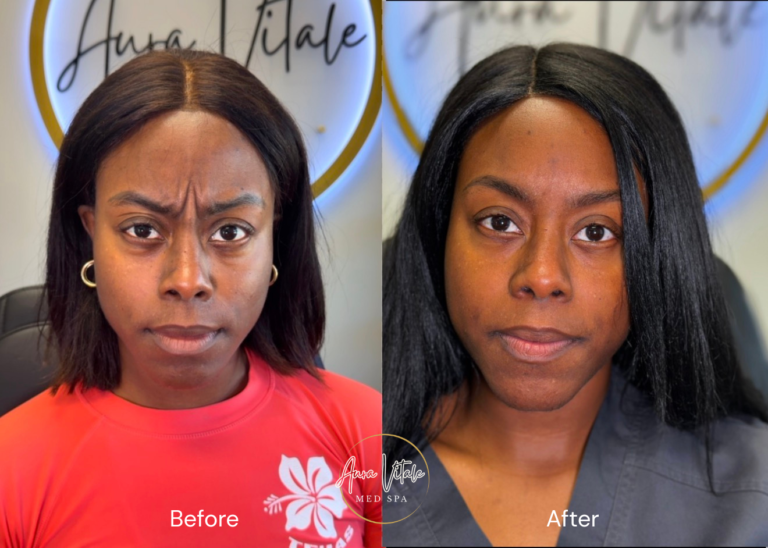 beforeafter template (do not delete) 2